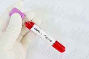 H5N1 positive